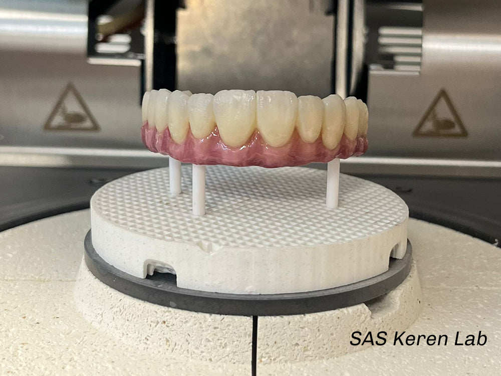 SAS Keren Lab MAX Case Study – Paris