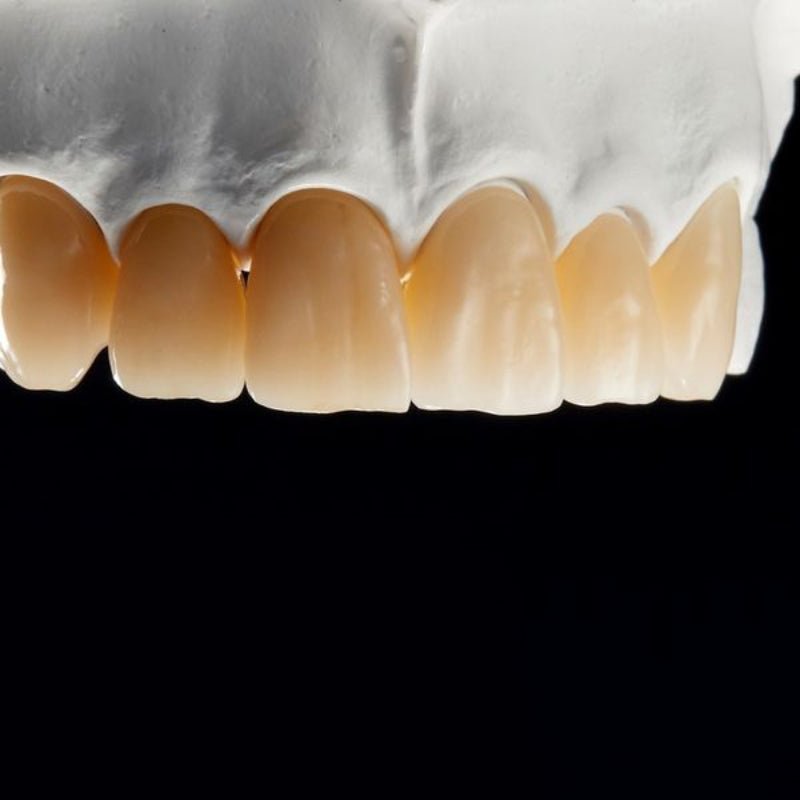 Overview of Multi-Layer Dental Zirconia Products - CeraDirect