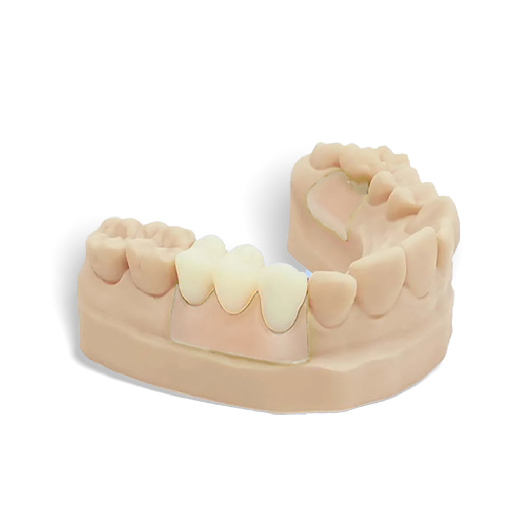 Résine Crown permanente pour imprimante 3D (500 g)