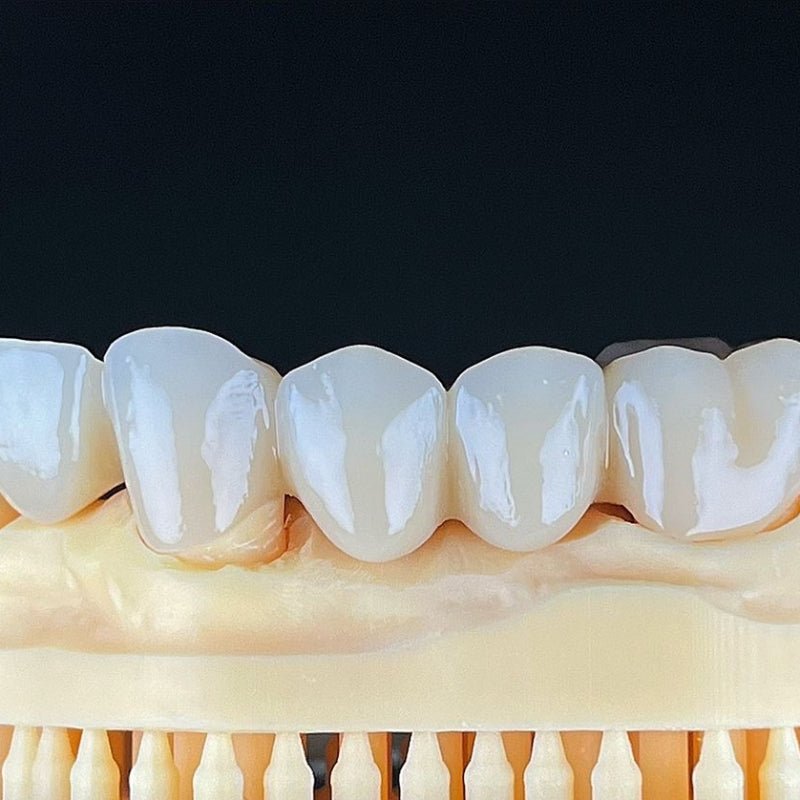 An In-Depth Look at Lithium Disilicate Veneers - CeraDirect