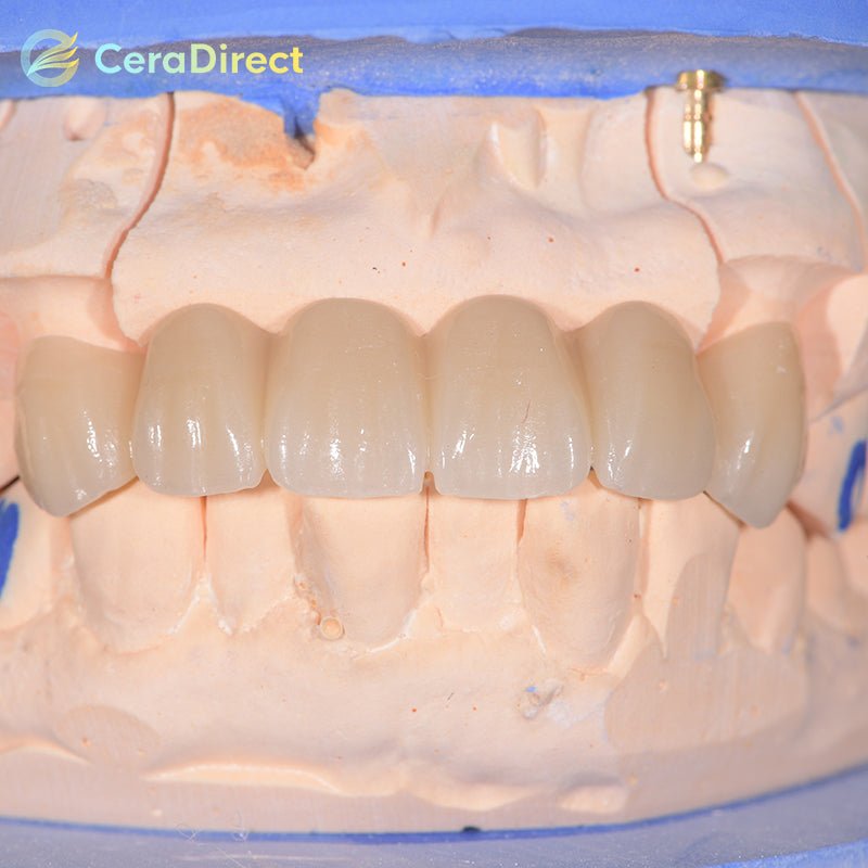 3D Pro—Multilayer Zirconia Disc AG System (71mm) - CeraDirect