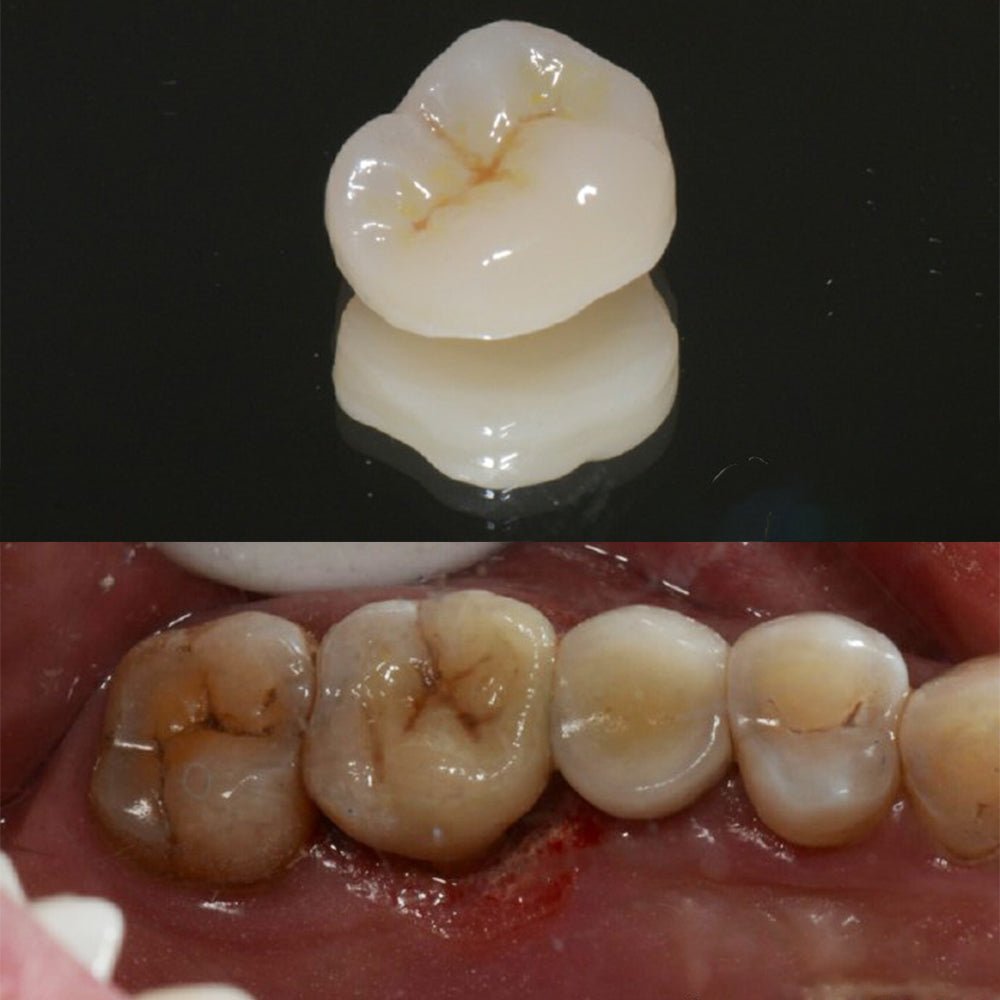 Hybrid Ceramic Monochrome —C14(12*14*18mm)-HT/LT(5 pieces) - CeraDirect