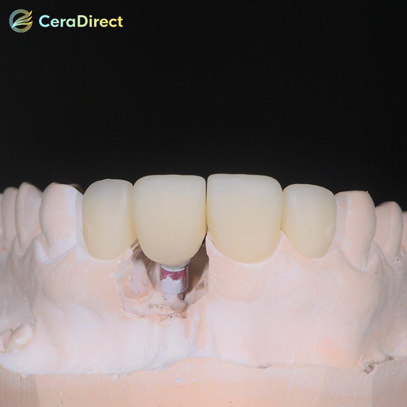 SHT+Color—Preshaded Zirconia Disc Open System (98mm) - CeraDirect